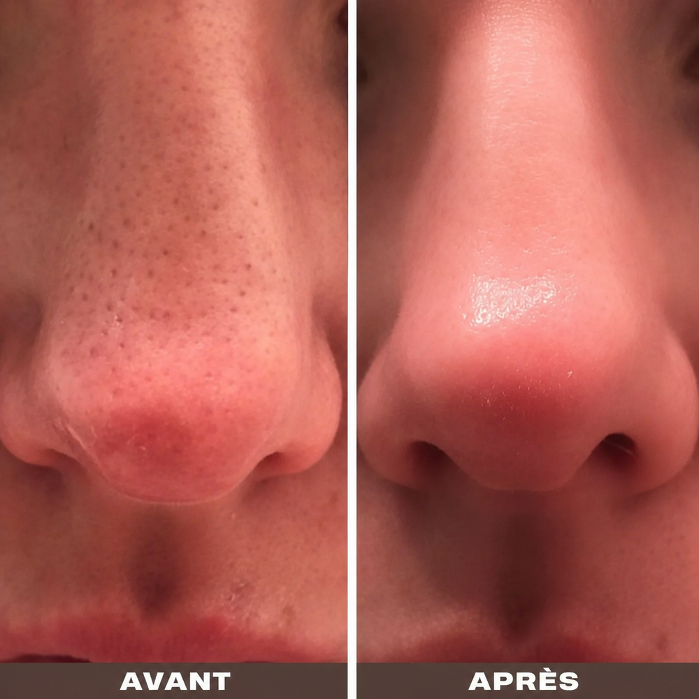 2. Fait ce que les patchs et les acides ne peuvent pas