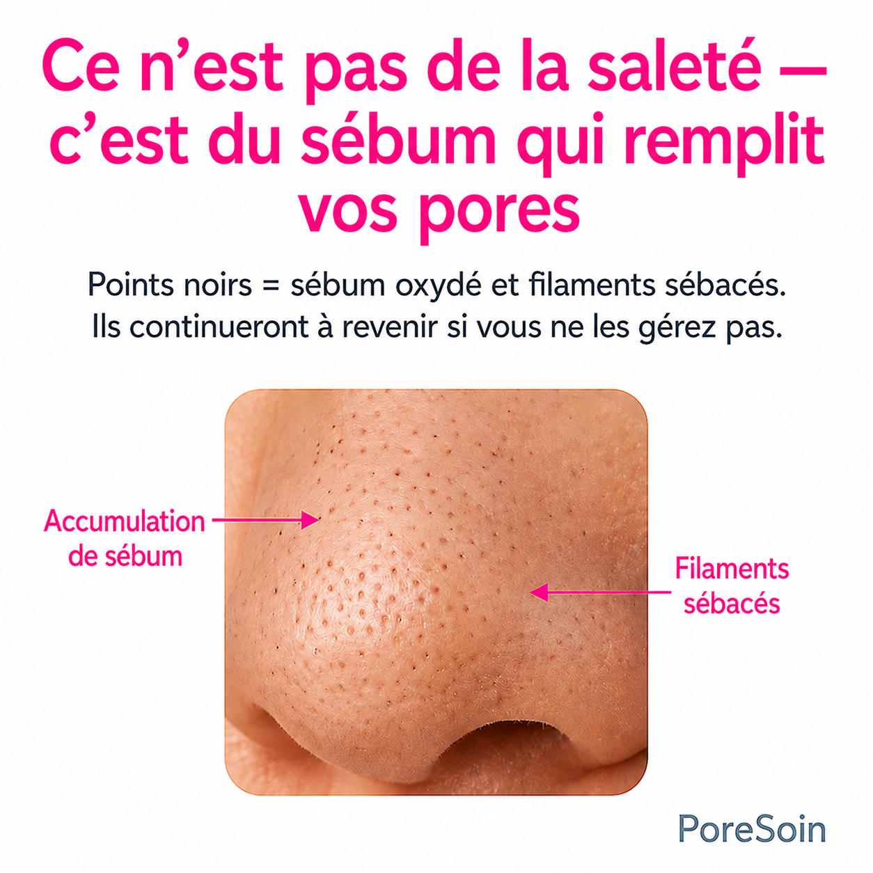 PoreSoin™