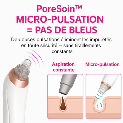 PoreSoin™